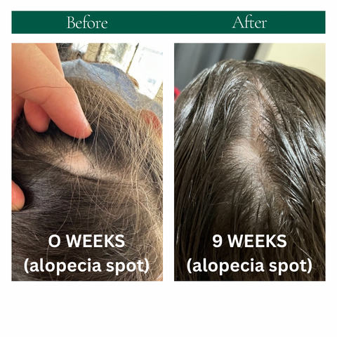 STRENGTHEN HAIR & SCALP OIL