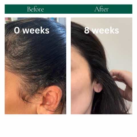 STRENGTHEN HAIR & SCALP OIL