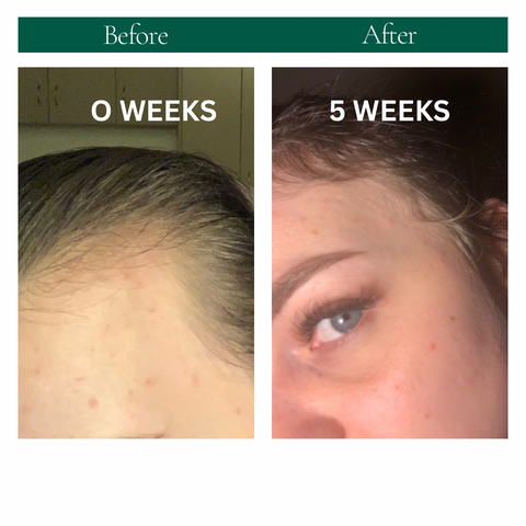 STRENGTHEN HAIR & SCALP OIL