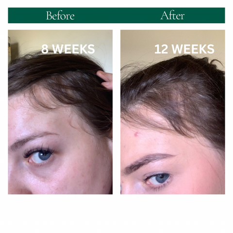 STRENGTHEN HAIR & SCALP OIL