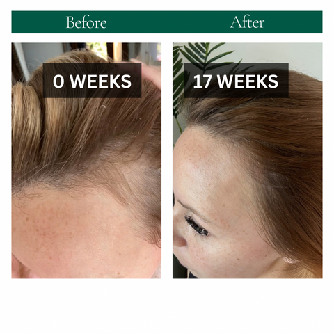 STRENGTHEN HAIR & SCALP OIL