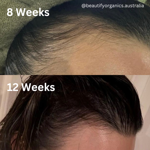 STRENGTHEN HAIR & SCALP OIL