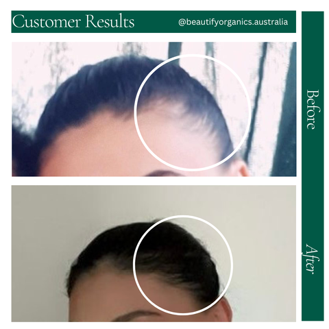 STRENGTHEN HAIR & SCALP OIL