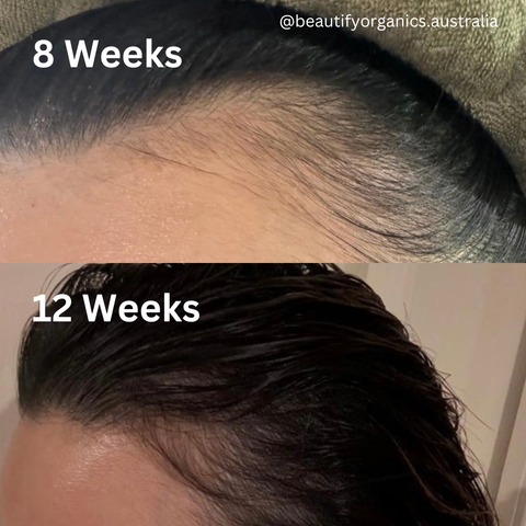 STRENGTHEN HAIR & SCALP OIL