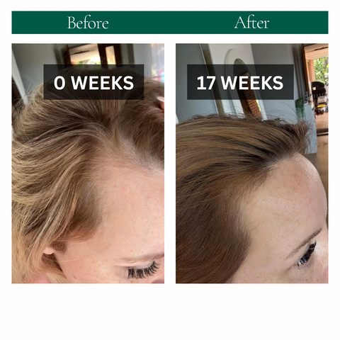 STRENGTHEN HAIR & SCALP OIL